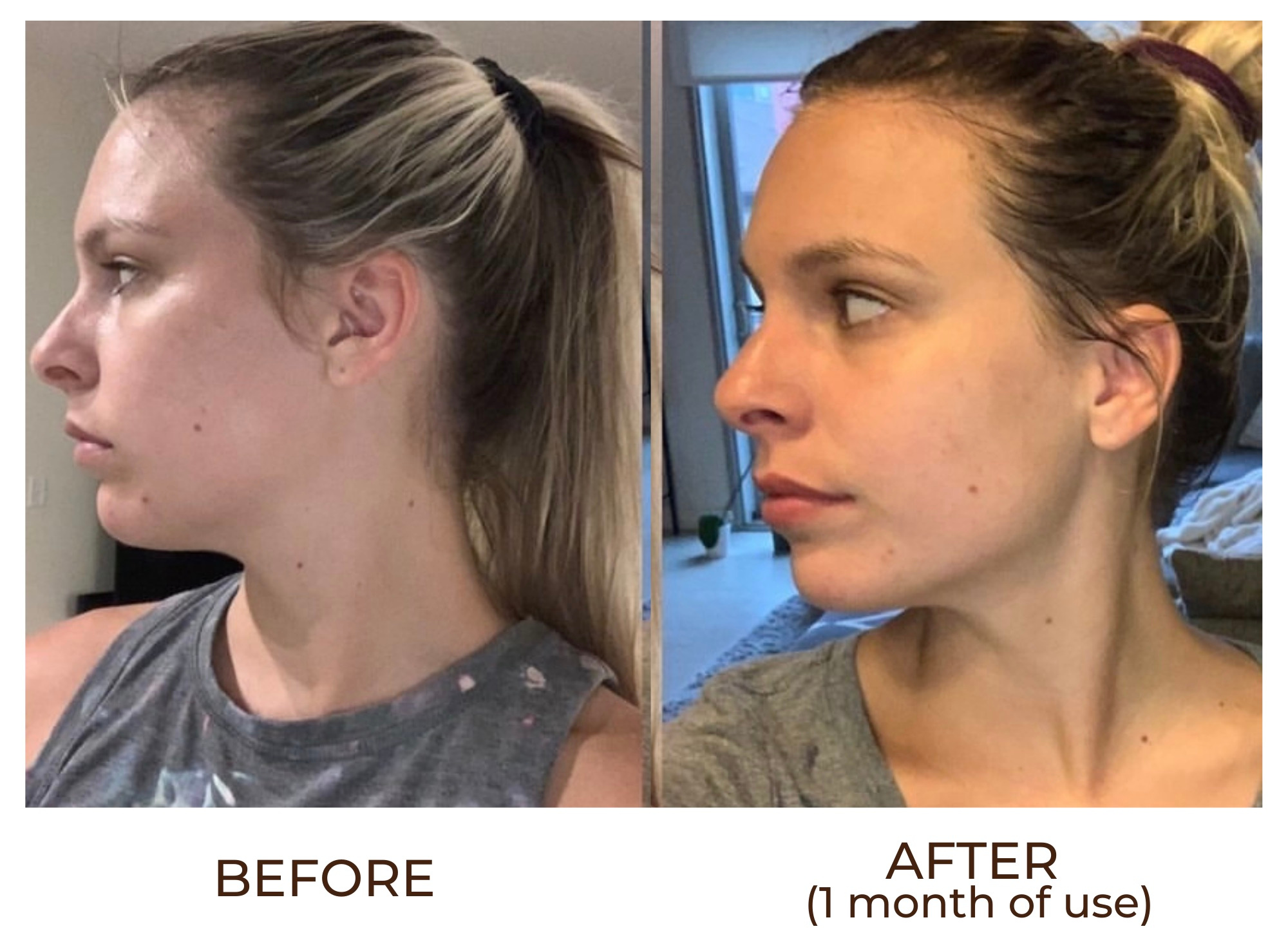 young-blond-woman-with-hair-pulled-back-showing-before-and-after-results-of-gua-sha-facial-massage